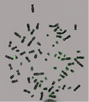 Cytogentics image