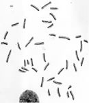 Cytogentics image