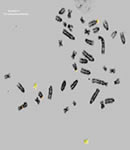 Cytogentics image