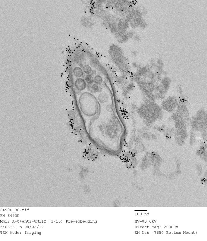 Post-embedding IEM (immunoelectron microscopy) image of a bacterium, with the dark spots (nano-gold particles) representing the locations of bacterial cell surface proteins. (Image and caption by Kunio Nagashima)