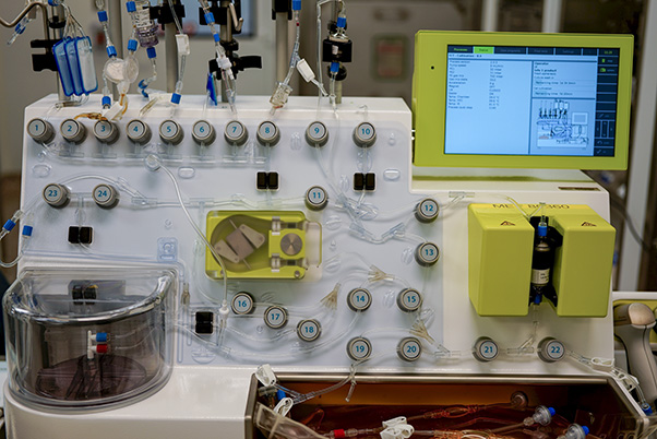 The CliniMACs Prodigy system. The chamber in the lower left is where the cells are washed, transduced with viral vector, and cultivated. The yellow pump in the center drives liquid flow through the system. The numbered knobs are valves that direct liquids and gases through the system. Valve 22 controls the tubing connected to the "harvest bag," which collects the CAR T cells. The yellow box to the right holds a magnet and column that separate T cells from other immune cells. (Photo provided by BDP)