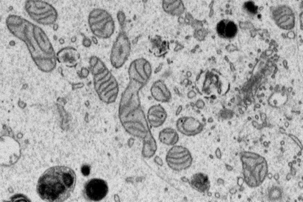 An electron microscopy image like the ones the participants are being asked to segment. Several mitochondria (gray blobs containing dark gray lines) are visible here. Participants would trace each of them individually.