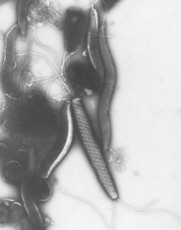 TEM image of Helicobacter pylori isolated from a mouse and stained using a negative stain method. H. pylori are the smooth-surfaced, curved bacteria in the background. The bacteria with surface patterns may be variants. (Image and caption by Kunio Nagashima)