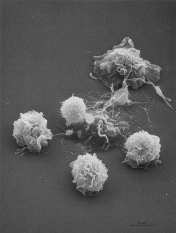 SEM image of several blood cell types: macrophages (large, flattened cells); lymphocytes (small, rounded cells attached to one of the macrophages); monocytes (three rounded cells with ruffles); and an activated platelet located between the macrophages. (Image and caption by Kunio Nagashima)