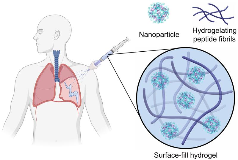 This figure shows how the nanoparticles become part of the surface-fill hydrogel that can then be applied via spray-gel applicator for treatment. Image by Anderson et al., Advanced Materials, courtesy of John Wiley and Sons, Copyright © 2024.