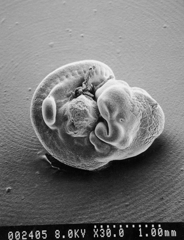 An SEM image of a mouse embryo. (Image and caption by Kunio Nagashima)
