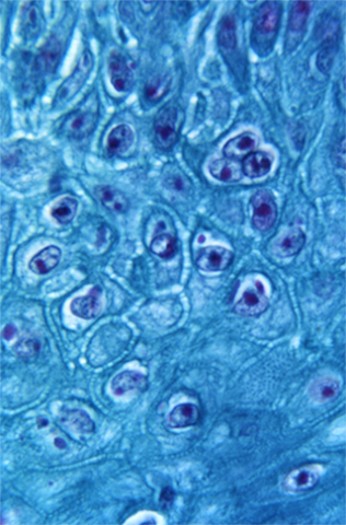 Color image of magnified monkeypox virus