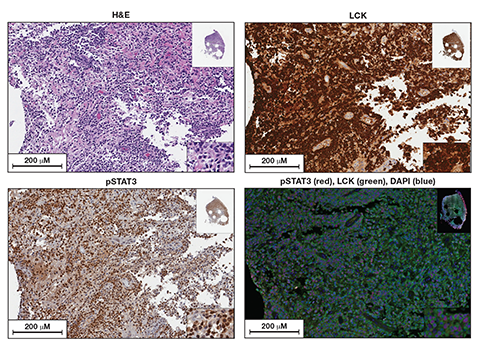 A composite image of staned tissue samples supporting the findings