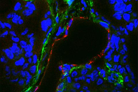 Immunofluorescence image of TEM8 in TNBC cells