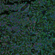 An image of a stained tissue sample
