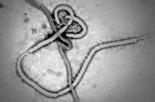 Ebola viral particle.