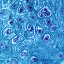 Color image of magnified monkeypox virus