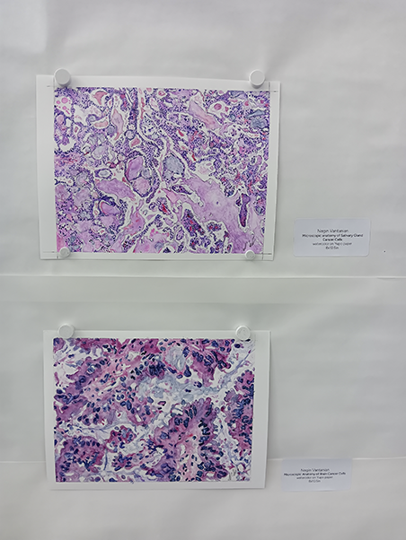Negin Vatanian’s watercolor painting, anatomy of salivary gland and brain cancer cells. (Photo by Victoria Brun.)