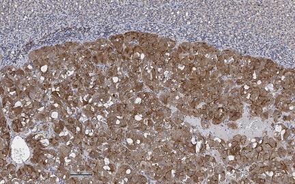 small beige cells at top and larger brown cells clustered at bottom